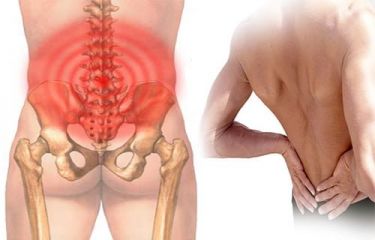Chứng đau thắt lưng và những phương pháp chữa trị hiệu quả nhất